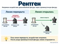 Рентген